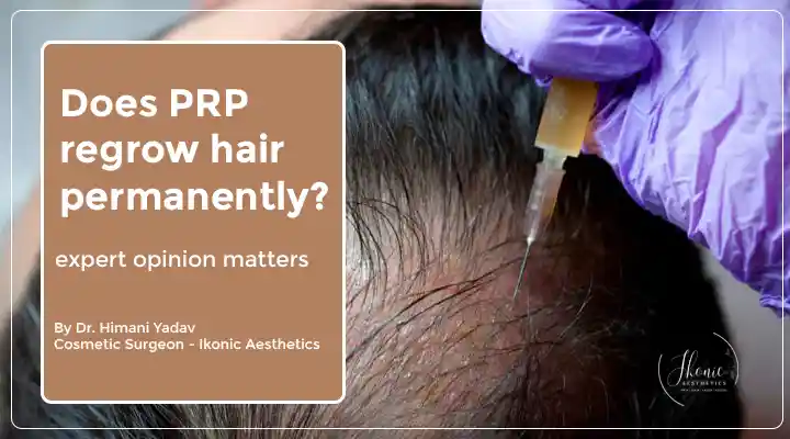 Hair PRP Treatment In Gurgaon