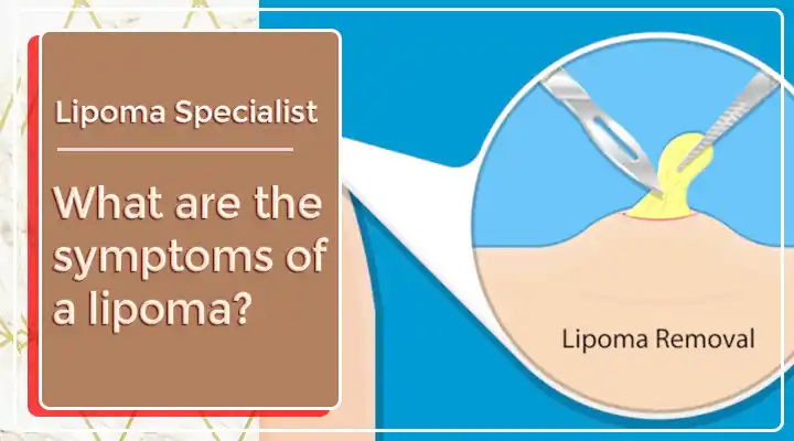 Lipoma Removal In Gurgaon