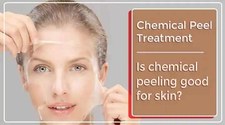 Chemical Peel Treatment In Gurgaon