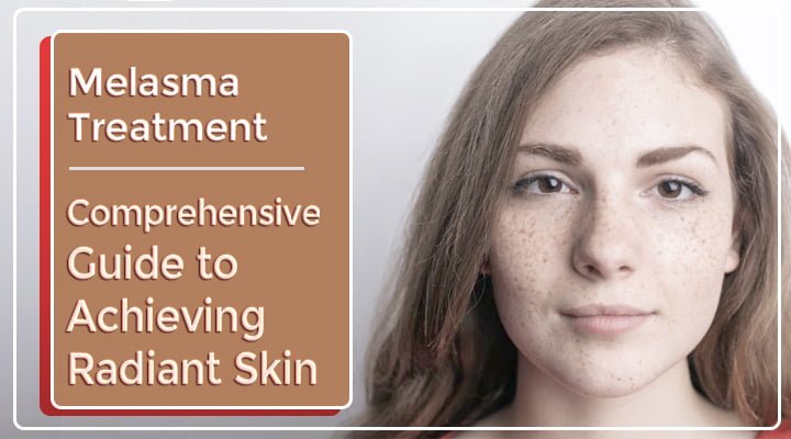 Melasma Treatment In Gurgaon