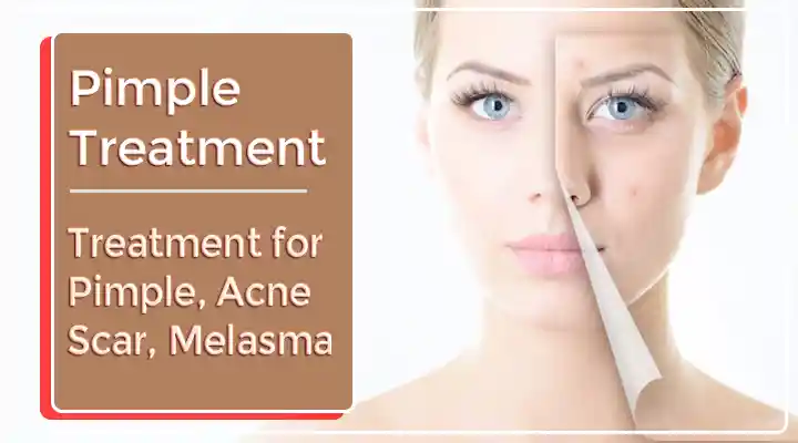 Pimple Treatment In Gurgaon