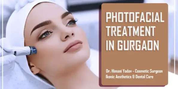 Photofacial Treatment In Gurgaon