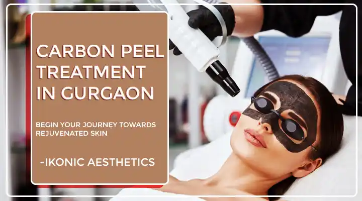 Carbon Peel Treatment In Gurgaon