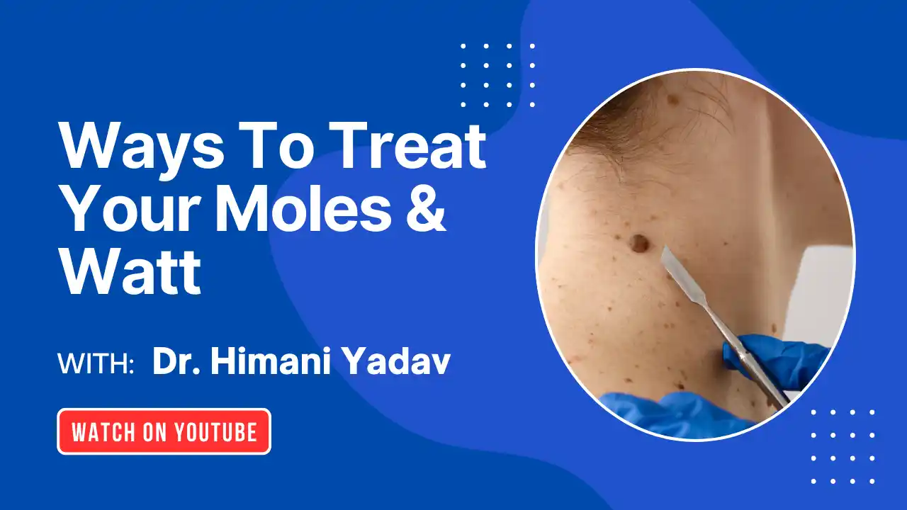 Mole Removal Treatment In Gurgaon