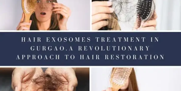 Hair Exosomes Treatment In Gurgaon, Sector 57