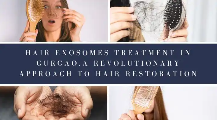 Hair Exosomes Treatment In Gurgaon, Sector 57