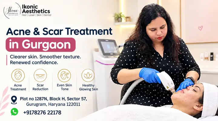 Acne & Scar Treatment in Gurgaon